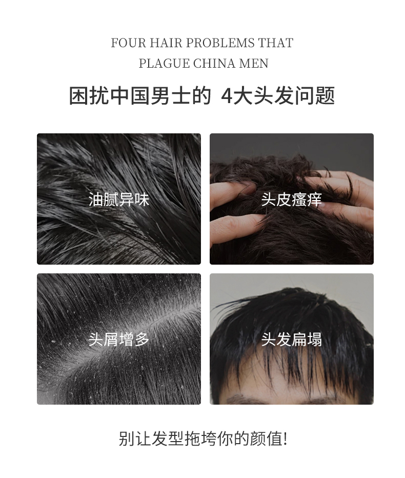 困擾中國男士的四大問(wèn)題，油膩異味、頭皮瘙癢、頭屑增多、頭發(fā)扁塌